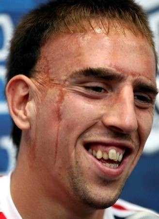 franck-ribery.jpg